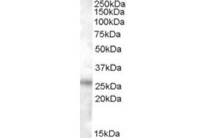 Image no. 1 for anti-Ras Association (RalGDS/AF-6) Domain Family Member 3 (RASSF3) (C-Term) antibody (ABIN374946) (RASSF3 anticorps  (C-Term))