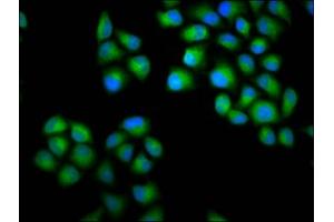Immunofluorescence staining of Hela cells with ABIN7147649 at 1:100, counter-stained with DAPI. (CHODL anticorps  (AA 105-206))