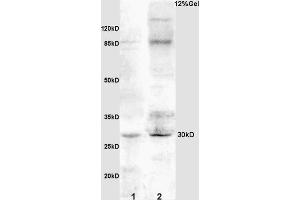 L1 rat kidney lysates L2 rat brain lysates probed with Anti IGFBP3 Polyclonal Antibody, Unconjugated (ABIN686497) at 1:200 overnight at 4 °C.