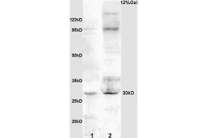 L1 rat kidney lysates L2 rat brain lysates probed with Anti IGFBP3 Polyclonal Antibody, Unconjugated (ABIN686497) at 1:200 overnight at 4 °C. (IGFBP3 anticorps  (AA 186-292))