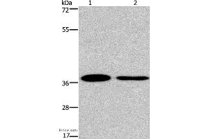 Western blot analysis of 293T and A549 cell, using SNAI1 Polyclonal Antibody at dilution of 1:200 (SNAIL anticorps)