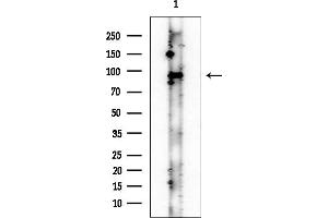anti-Espin (ESPN) antibody