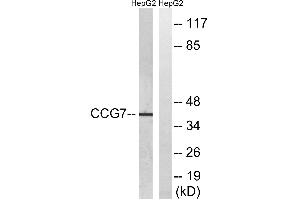 Western blot analysis of extracts from HepG2 cells, using CACNG7 antibody. (CACNG7 anticorps  (Internal Region))
