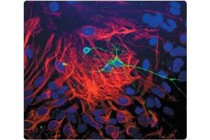 Dissociated cell culture of a neonatal Mouse brain showing Beta-Tubulin III (green staining) of neurons.