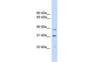 Image no. 1 for anti-CCAAT/enhancer Binding Protein (C/EBP), alpha (CEBPA) (AA 265-314) antibody (ABIN6745500) (CEBPA anticorps  (AA 265-314))