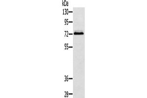 Western Blotting (WB) image for anti-Synovial Sarcoma, X Breakpoint 2 Interacting Protein (SSX2IP) antibody (ABIN2424211) (SSX2IP anticorps)