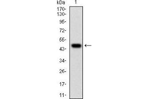 Western blot analysis using WT1 mAb against human WT1 (AA: 314-479) recombinant protein. (WT1 anticorps  (AA 314-479))