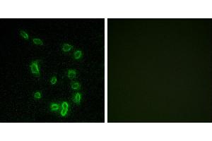 P-peptide - +Immunofluorescence analysis of HepG2 cells, using DARPP-32 (Phospho-Thr34) antibody. (DARPP32 anticorps  (pThr34))