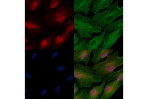 Phospho-MeCP2 (Ser423) Antibody staining A549 cells(heat shock treatment) by IF/ICC.