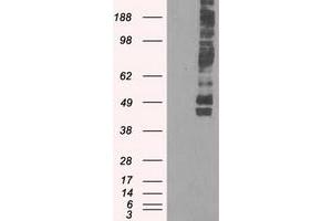 Image no. 4 for anti-Solute Carrier Family 2 (Facilitated Glucose/fructose Transporter), Member 5 (SLC2A5) antibody (ABIN1498478) (SLC2A5 anticorps)