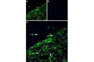 Expression of GIRK2 (Kir3. (Potassium Inwardly-Rectifying Channel, Subfamily J, Member 6 (KCNJ6) Peptide)