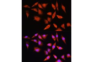 Immunofluorescence analysis of L929 cells using HSP antibody (ABIN6128040, ABIN6142040, ABIN6142041 and ABIN6223893) at dilution of 1:100. (HSPA2 anticorps  (AA 400-639))