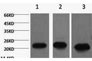 Western Blot analysis of 1) MCF7, 2) Rat kidney, 3) Mouse brain using PRDX1 Monoclonal Antibody at dilution of 1:2000. (Peroxiredoxin 1 anticorps)