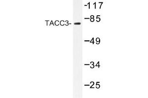 Image no. 1 for anti-Transforming, Acidic Coiled-Coil Containing Protein 3 (TACC3) antibody (ABIN317622) (TACC3 anticorps)