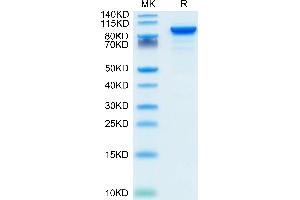 Ectonucleotide Pyrophosphatase / phosphodiesterase 2 (ENPP2) (AA 49-862) protein (His tag)