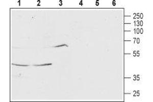 Western blot analysis of rat brain (lanes 1 and 4), mouse brain (lanes 2 and 5) and human SH-SY5Y (lanes 3 and 6) lysates: - 1-3. (MCHR1 anticorps  (Extracellular, N-Term))