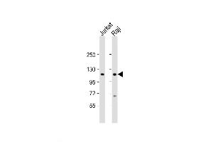 Western Blot at 1:2000 dilution Lane 1: Jurkat whole cell lysate Lane 2: Raji whole cell lysate Lysates/proteins at 20 ug per lane. (WHSC1 anticorps  (C-Term))