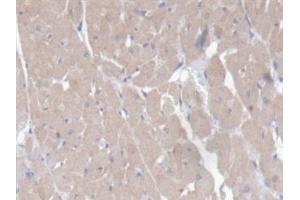 Detection of CD7 in Rat Heart Tissue using Polyclonal Antibody to Cluster Of Differentiation 7 (CD7) (CD7 anticorps  (AA 23-128))