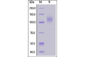 SARS-CoV-2 S1 protein, His Tag on  under reducing (R) condition.