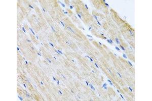 Immunohistochemistry of paraffin-embedded Mouse heart using ABCB8 Polyclonal Antibody at dilution of 1:100 (40x lens).