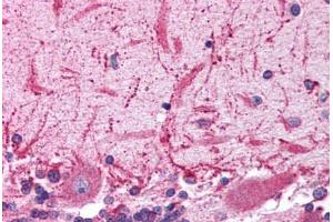 Human Brain, Cerebellum (formalin-fixed, paraffin-embedded) stained with GRIK2 antibody ABIN214767 at 5 ug/ml followed by biotinylated goat anti-rabbit IgG secondary antibody ABIN481713, alkaline phosphatase-streptavidin and chromogen.