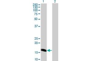 Western Blot analysis of BARX1 expression in transfected 293T cell line by BARX1 monoclonal antibody (M01A), clone 1E7. (BARX1 anticorps  (AA 1-100))