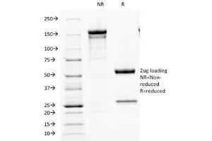 SDS-PAGE Analysis of Purified, BSA-Free Parathyroid Hormone Antibody (clone PTH/1173). (PTH anticorps  (AA 32-115))