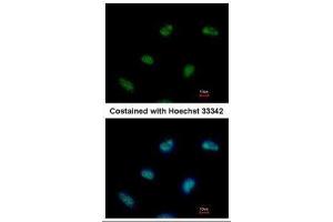 ICC/IF Image Immunofluorescence analysis of paraformaldehyde-fixed HeLa, using Rad9, antibody at 1:500 dilution. (RAD9A anticorps  (Center))