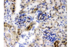 IHC analysis of Nestin using anti-Nestin antibody .