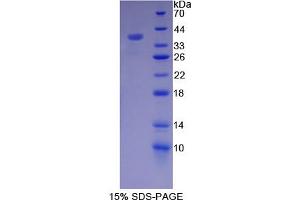 Image no. 1 for Actinin, alpha 4 (ACTN4) (AA 1-269) protein (His tag) (ABIN6237775)