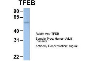 Host: Rabbit  Target Name: TFEB  Sample Tissue: Human Adult Placenta  Antibody Dilution: 1. (TFEB anticorps  (Middle Region))