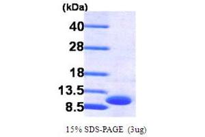 SDS-PAGE (SDS) image for Growth Regulated Oncogene gamma (GRO gamma) (AA 35-107) protein (His tag) (ABIN666724)