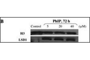 Western immunoblot.