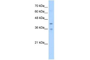 TMEM104 antibody used at 5 ug/ml to detect target protein. (TMEM104 anticorps  (Middle Region))