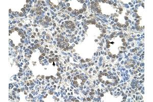 SLC26A5 antibody was used for immunohistochemistry at a concentration of 4-8 ug/ml to stain Alveolar cells (arrows) in Human Lung. (SLC26A5 anticorps)