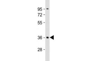 Western blot testing of human brain lysate with PLK5 antibody at 1:2000. (PLK5 anticorps  (AA 140-174))