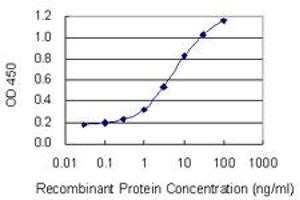Detection limit for recombinant GST tagged SIX2 is 0. (SIX2 anticorps  (AA 1-291))