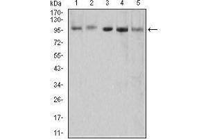 Western blot analysis using XRN2 mouse mAb against HEK293 (1), NTERA-2 (2), LNcap (3), HepG2 (4), and PC-3 (5) cell lysate. (XRN2 anticorps  (AA 398-547))