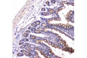 IHC testing of FFPE rat small intestine tissue with RAB27A antibody at 1ug/ml. (RAB27A anticorps)
