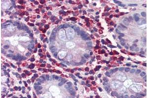 Human Colon (formalin-fixed, paraffin-embedded) stained with TRIM21 antibody ABIN337310 at 5 ug/ml followed by biotinylated anti-goat IgG secondary antibody ABIN481715, alkaline phosphatase-streptavidin and chromogen. (TRIM21 anticorps  (AA 386-398))