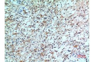 Immunohistochemistry (IHC) analysis of paraffin-embedded Human Brain, antibody was diluted at 1:100.