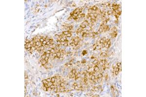 Immunohistochemistry of paraffin-embedded rat testis using B Rabbit pAb (ABIN6131247, ABIN6137447, ABIN6137448 and ABIN6222194) at dilution of 1:50 (40x lens).