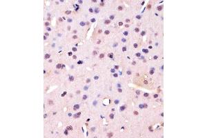 (ABIN1882273 and ABIN2838445) staining PCNA in Rat brain tissue sections by Immunohistochemistry (IHC-P - paraformaldehyde-fixed, paraffin-embedded sections).