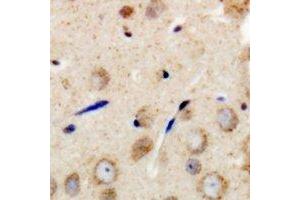 Immunohistochemical analysis of GAB1 staining in human brain formalin fixed paraffin embedded tissue section. (GAB1 anticorps  (C-Term))