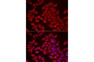 Immunofluorescence analysis of HeLa cells using  antibody (ABIN6129825, ABIN6136640, ABIN6136641 and ABIN6222174).