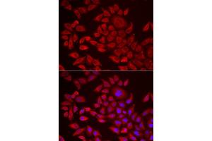 Immunofluorescence analysis of HeLa cells using  antibody (ABIN6129825, ABIN6136640, ABIN6136641 and ABIN6222174). (AGPAT2 anticorps  (AA 199-278))
