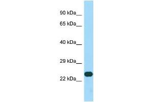 Host: Rabbit Target Name: CCDC59 Sample Type: HepG2 Whole Cell lysates Antibody Dilution: 1. (CCDC59 anticorps  (C-Term))
