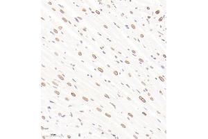 Immunohistochemistry of paraffin embedded rat heart using ADI1 (ABIN7072888) at dilution of 1:1600 (300x lens)