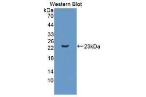 Western blot analysis of recombinant Mouse IL11. (IL-11 anticorps  (AA 25-199))
