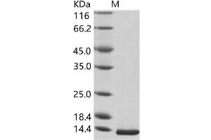 Western Blotting (WB) image for West Nile Virus Envelope (WNV E) protein (His tag) (ABIN7198742)